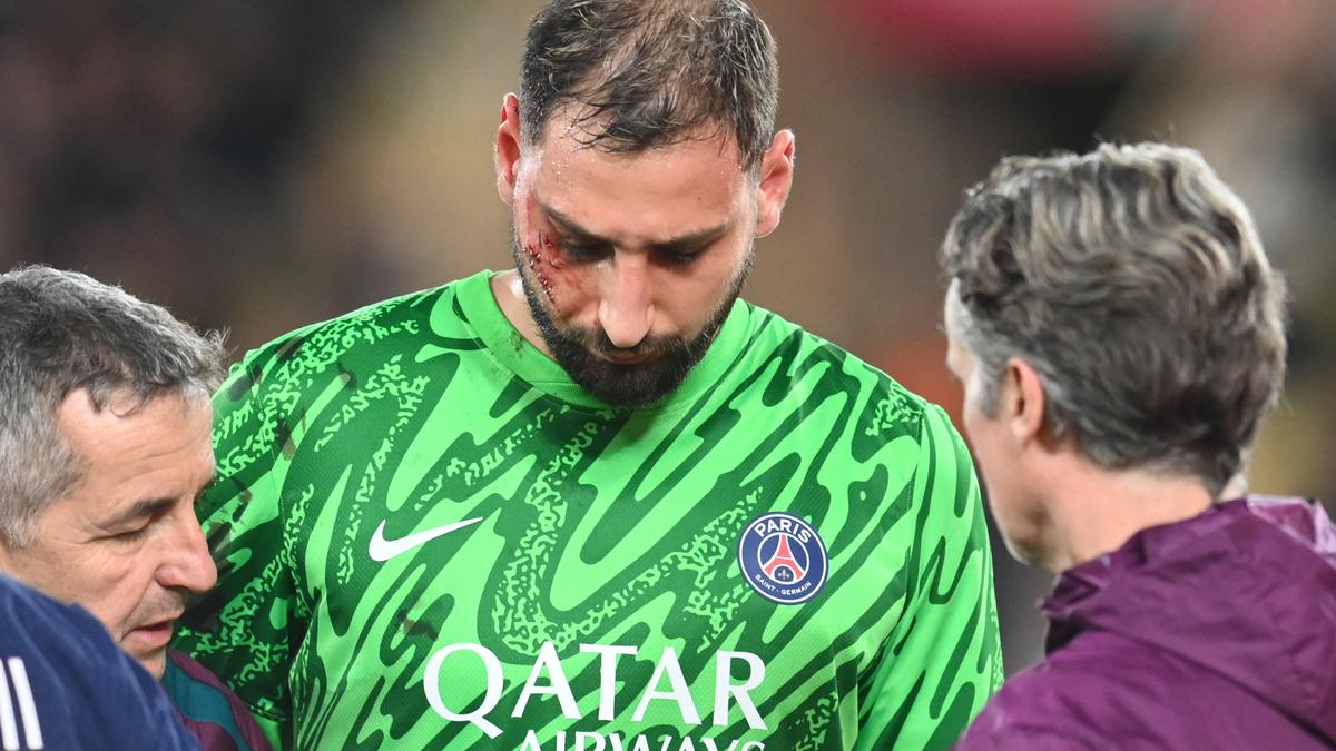 Donnarumma fit for French Super Cup after bad face injury