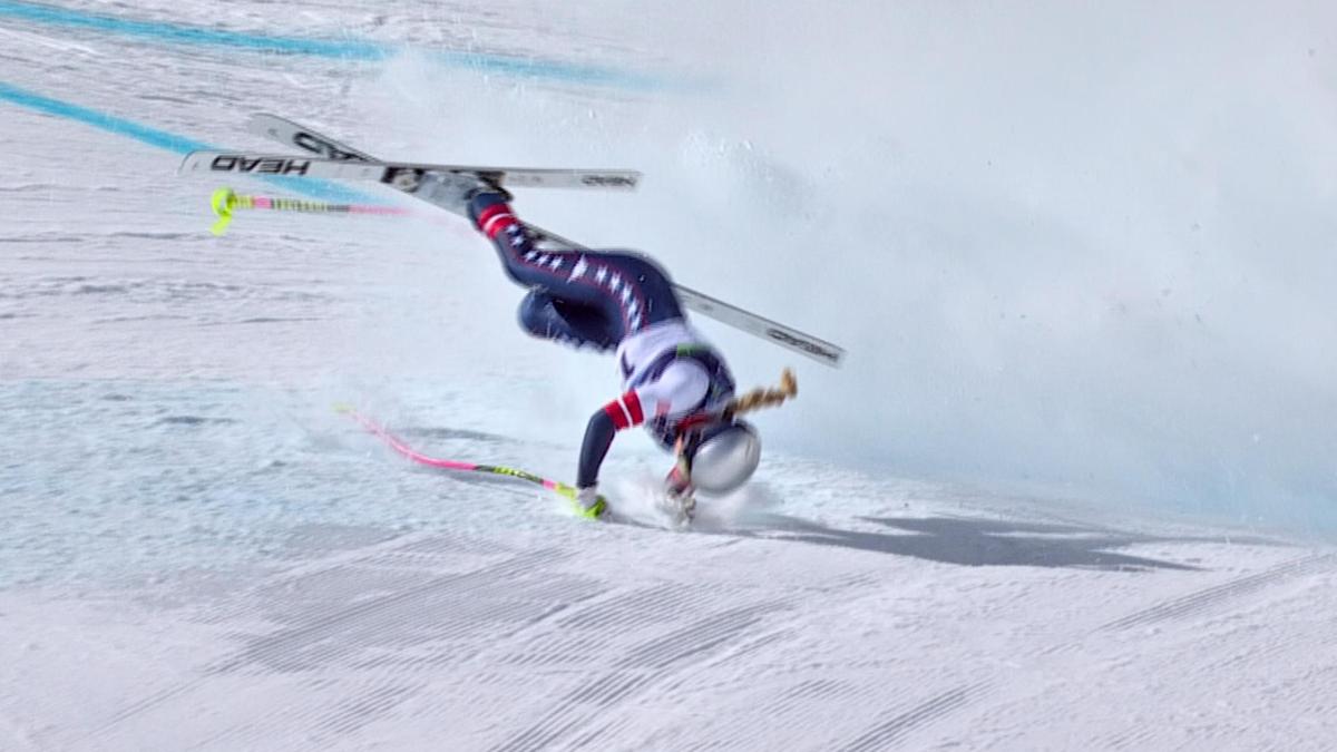 Alpine ski great Vonn says she needs multiple surgeries for complex leg ...