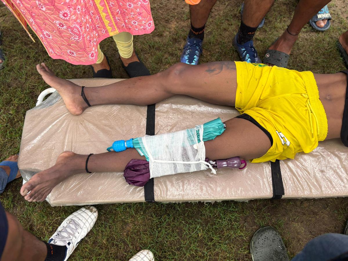 Na divisão de estreia da Liga de Futebol em Calcutá, os guarda -chuvas foram chocantemente usados como aparelhos improvisados para estabilizar as pernas de Taraki Hambram. Na divisão de estreia da Liga de Futebol em Calcutá, os guarda -chuvas foram chocantemente usados como aparelhos improvisados para estabilizar as pernas de Taraki Hambram.