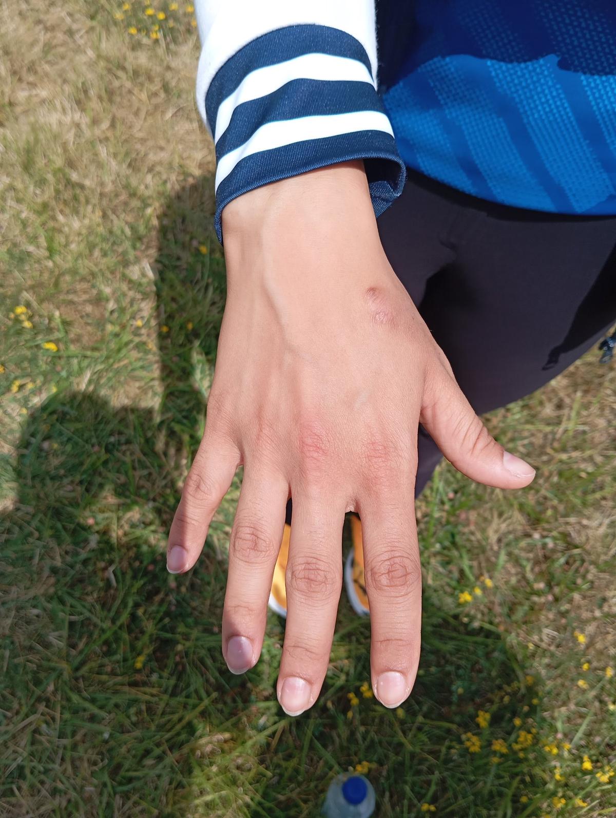 The pressure sore around Manu Bhaker’s thumb and forefinger is a memento of the sport of her calling. 